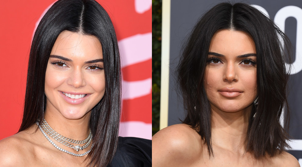 Kendall Jenner antes (izquierda) y después de los retoques estéticos...