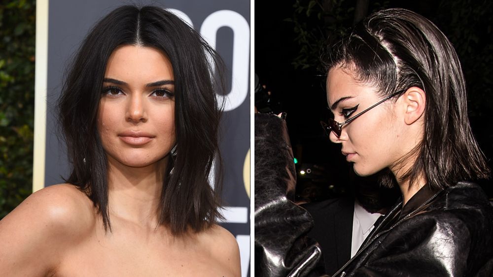 A la izquierda, la top Kendall Jenner en la pasada edición de los Globos de Oro 2018, en la que también incendió las redes por sus problemas de acné. A la derecha, la top con marcas en la piel fruto del acné adulto que padece desde hace años.