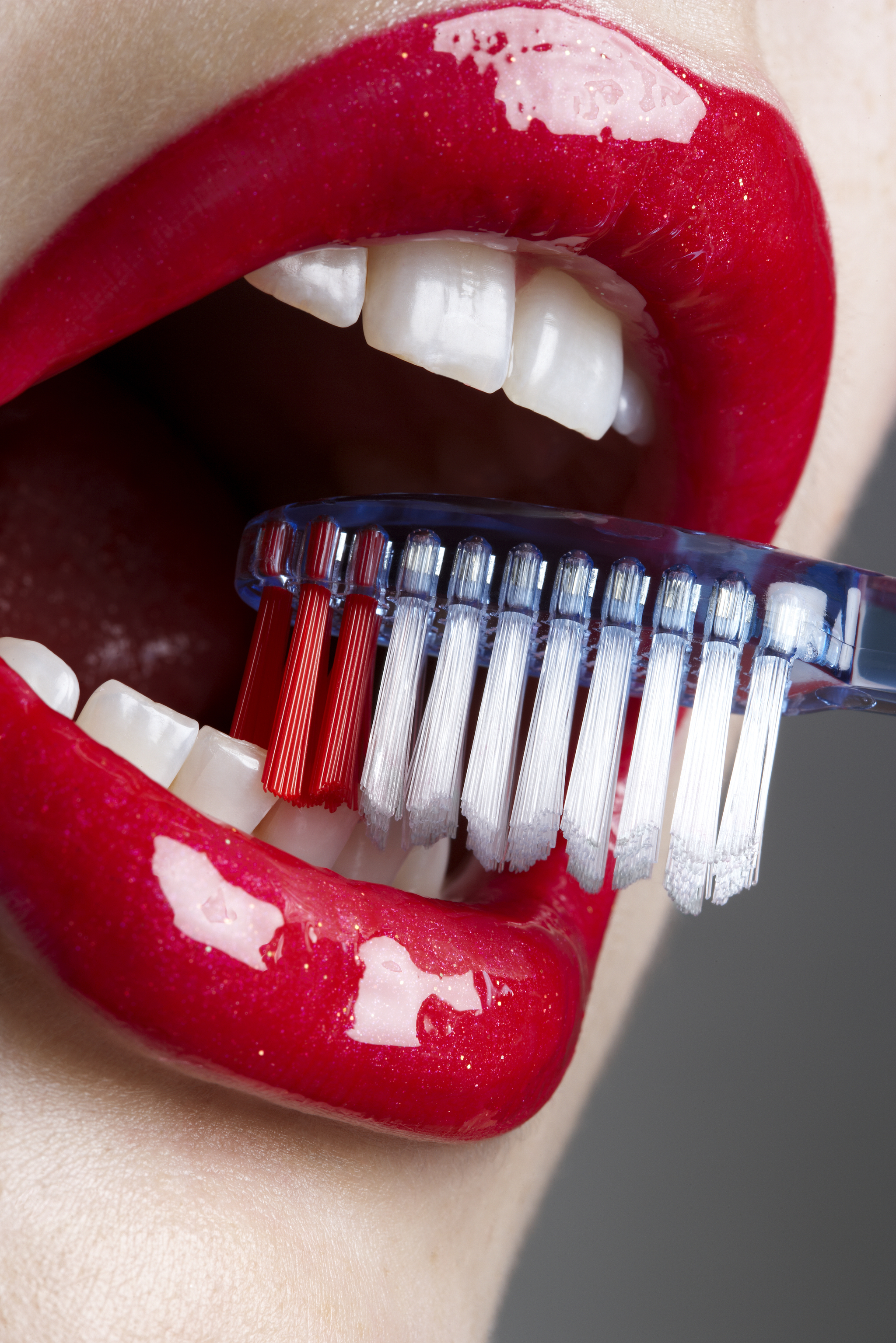 La higiene dental tiene que ser muy exhaustiva cuando nos realizamos un tratamiento de ortodoncia.