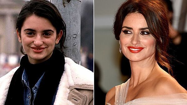 Descubre, foto a foto, el antes y el después de los retoques estéticos de los famosos.