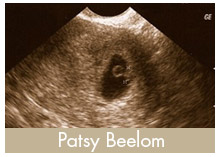 Patsy Beelom